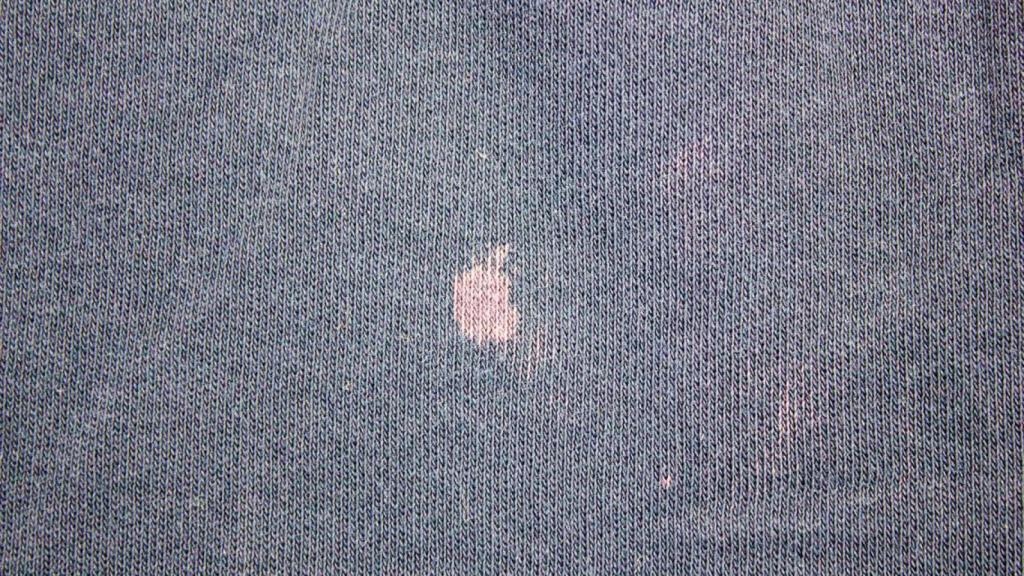 Unas manchas de lejía.