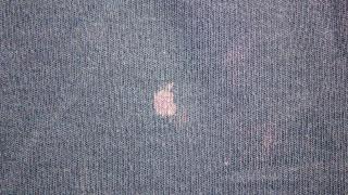 Unas manchas de lejía.