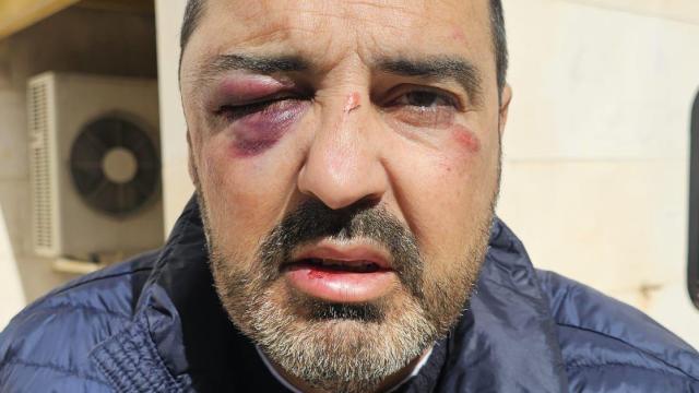 Así le dejaron la cara a José Antonio.