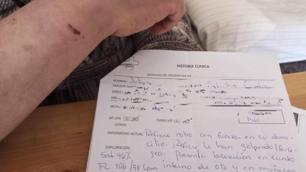 Julián, este lunes, mostrado una herida en su muñeca derecha, aún inflamada, a causa del tirón que le dieron los ladrones para quitarle una esclava valorada en 3.300 euros.