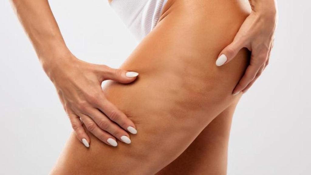 Mujer señalándose la celulitis de su muslo.