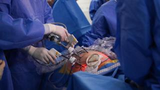 Cirugía de cáncer colonrectal.