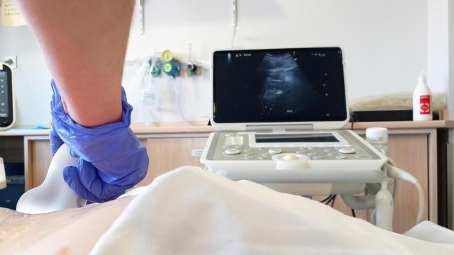 Prueba de imagen diagnóstica para el cáncer de colon.