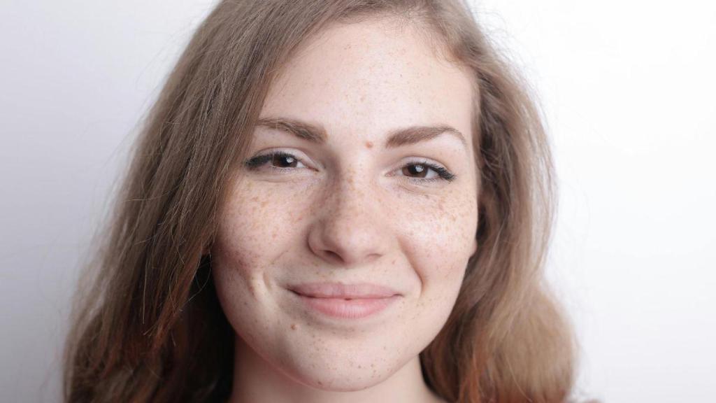 Este es el sérum despigmentante que recomiendan los dermatólogos para tratar manchas