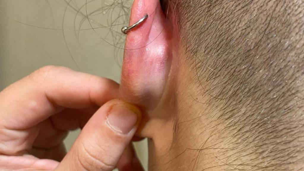 Así quedó la oreja de la jugadora agredida