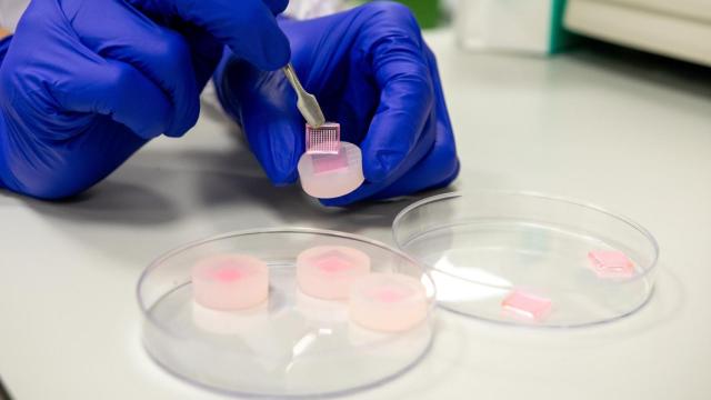 Parche con microagujas para curar heridas crónicas