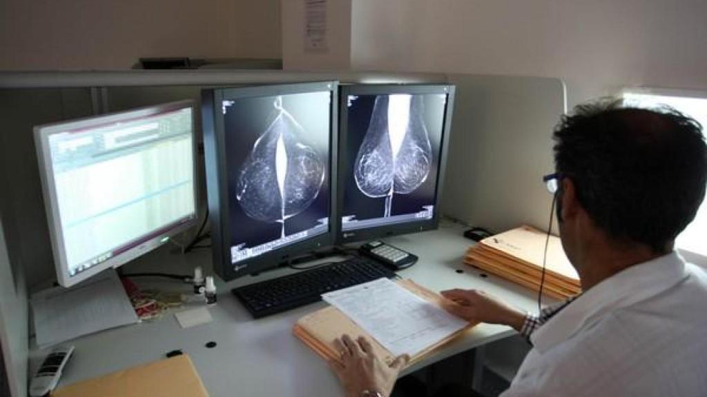 Estudio una mamografía digital, en el servicio de mamografías del Hospital Río Hortega de Valladolid