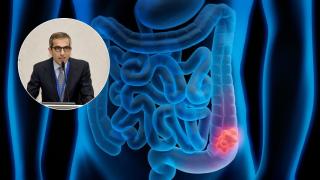 roberto-persiani-oncologo-alimento-consumido-espana-disminuye-riesgo-cancer