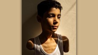 Mahmoud Ajjour, nueve años. Foto: Samar Abu Elouf, para The New York Times (detalle). Fotografía ganadora del World Press Photo 2025