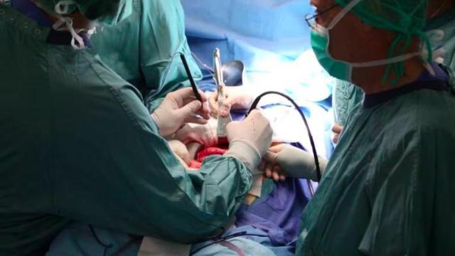 Intervención de un cáncer de páncreas.