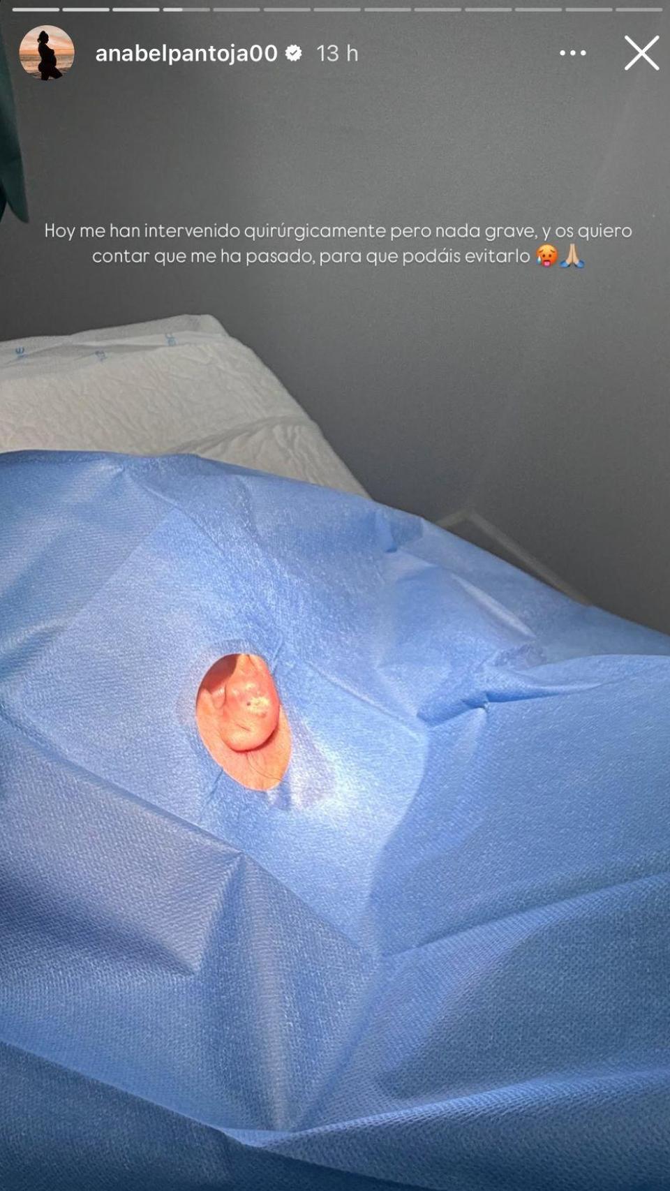 Anabel Pantoja ha contado los detalles de su intervención en sus redes.