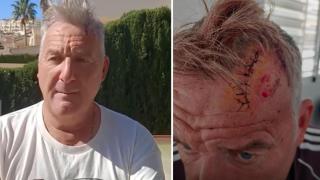 David Homer muestra las heridas tras el ataque.