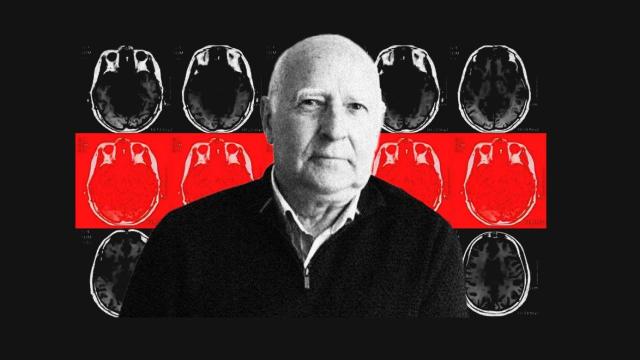 El neurólogo Arturo Goicoechea.