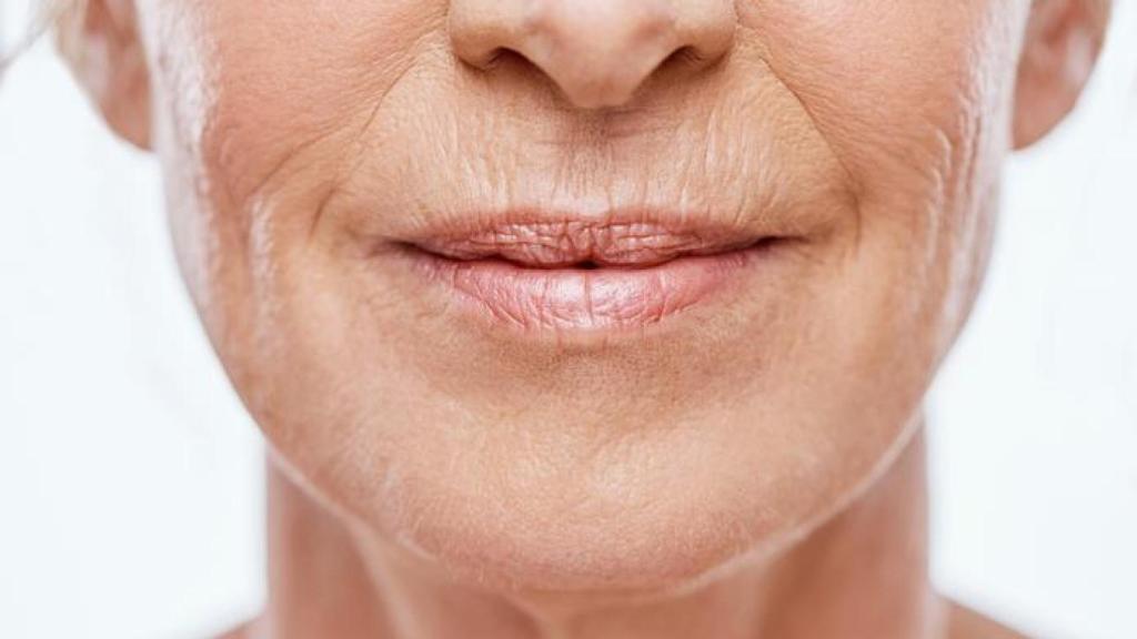 Imagen ilustrativa de la piel de una mujer.