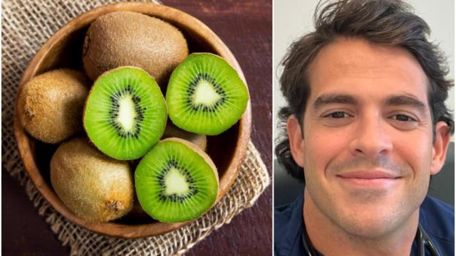 Aurelio Rojas, cardiólogo, sobre los beneficios de los kiwis.