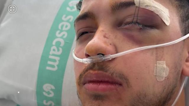 Abdessamad Mokhtar El Kharaifi, el árbitro de fútbol sala agredido en Guadalajara.