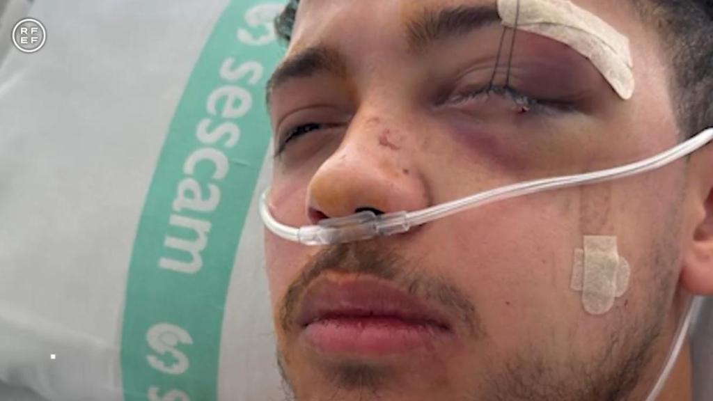 Abdessamad Mokhtar El Kharaifi, el árbitro de fútbol sala agredido en Guadalajara.