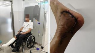 A la izquierda, Miguel Ángel C. postrado en una silla de ruedas; a la derecha, una de las lesiones sufridas.