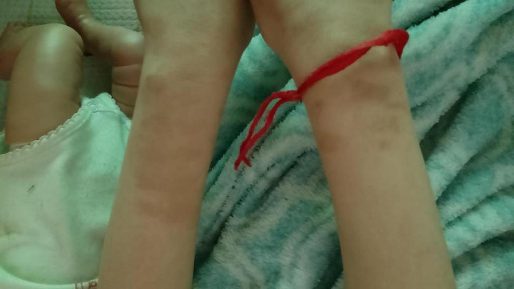 Los brazos de la niña.