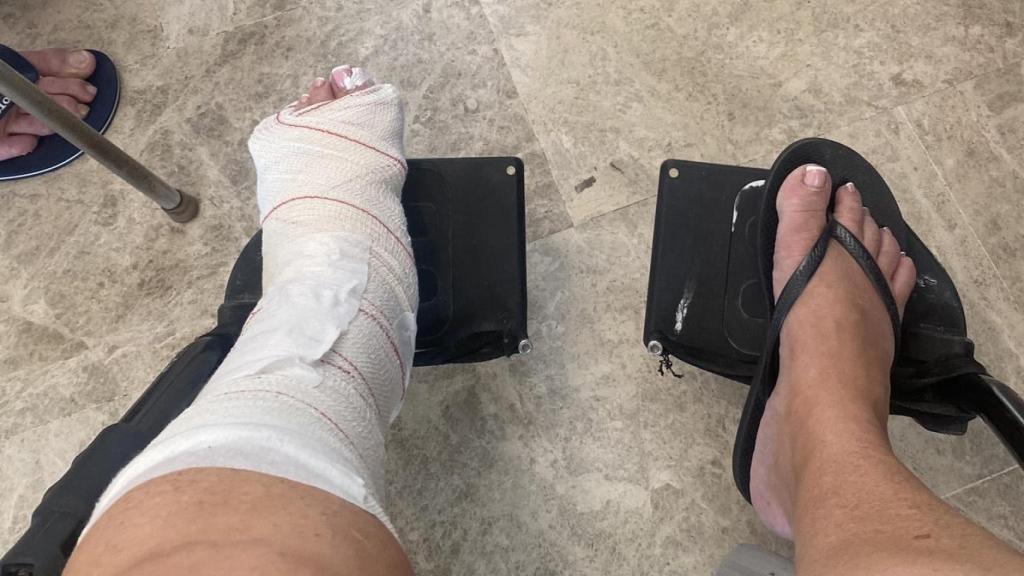 Otra turista con lesiones.