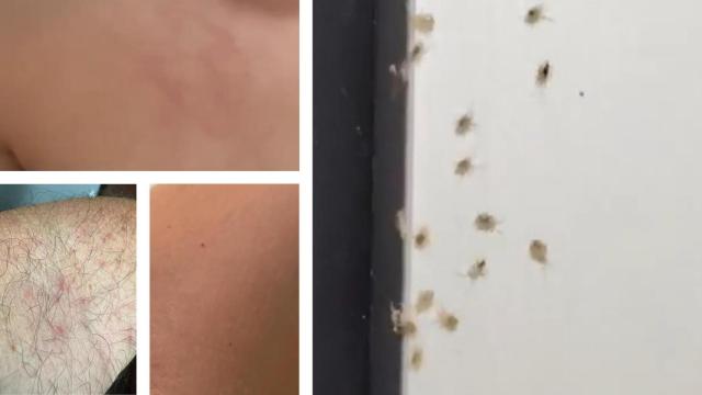 Algunas ronchas y los insectos.