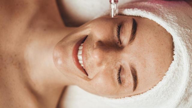 Protocolo con exosomas a través de microagujas.