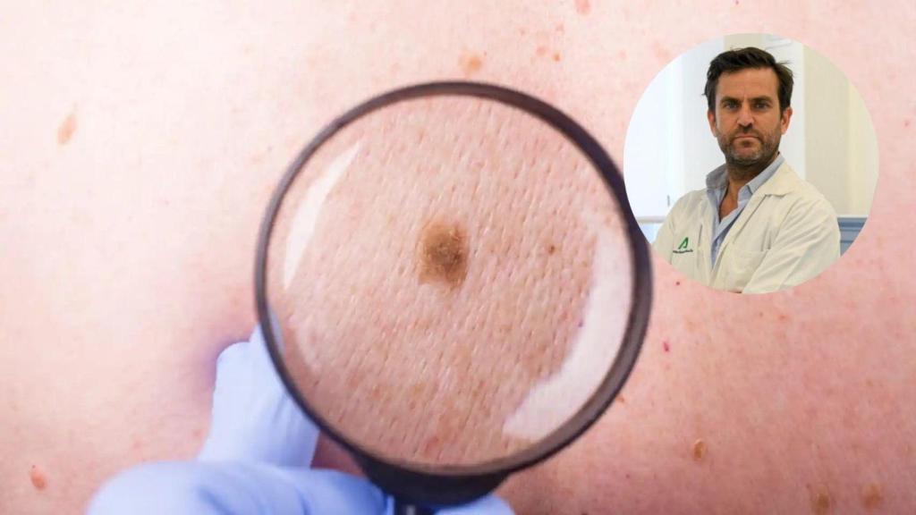 Un lunar y el dermatólogo Enrique Herrera en un montaje.