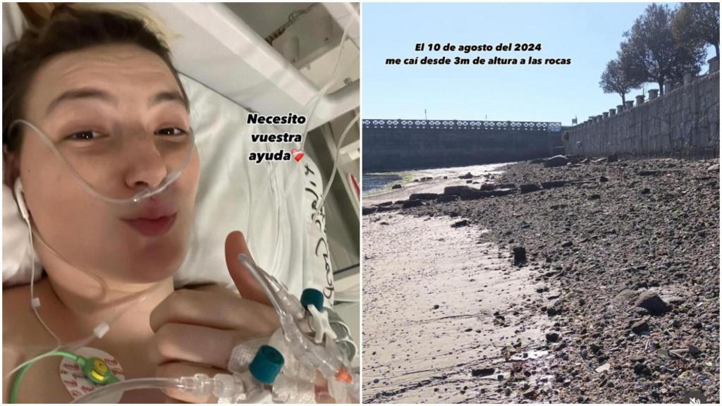 Una joven hospitalizada en Vigo pide ayuda para encontrar a alguien con su misma dolencia medular