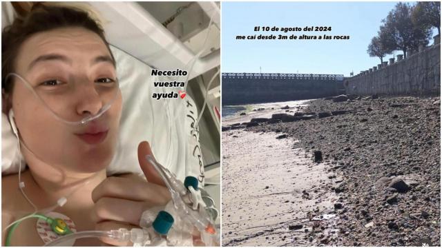 Una joven hospitalizada en Vigo pide ayuda para encontrar a alguien con su misma dolencia medular