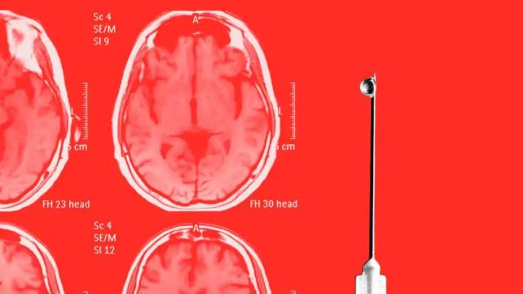 Se espera que este test llegue a Europa próximamente.