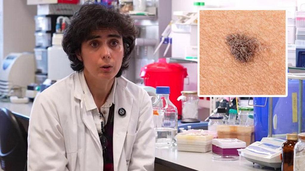 María Luisa del Río, una de las investigadoras, y un melanoma