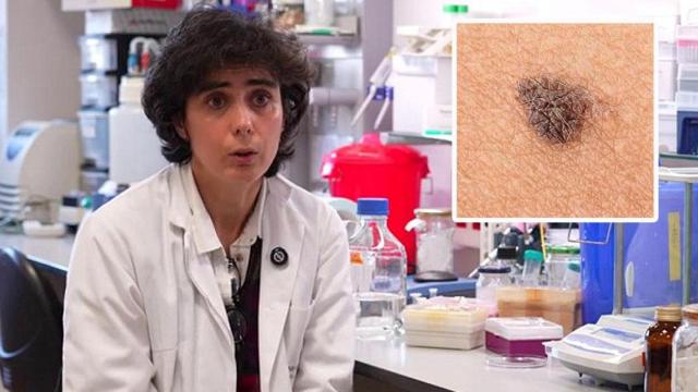 María Luisa del Río, una de las investigadoras, y un melanoma