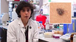 María Luisa del Río, una de las investigadoras, y un melanoma