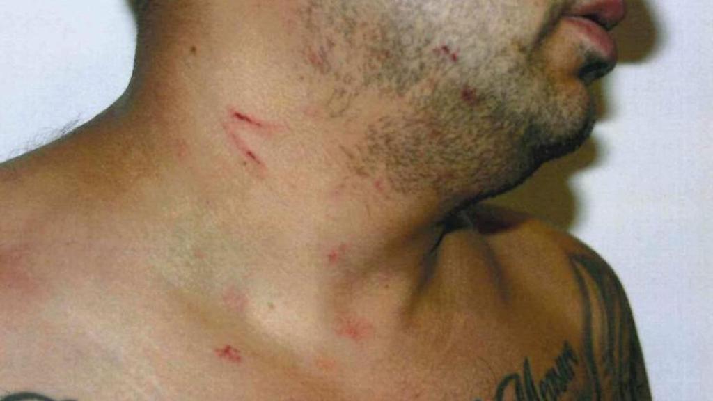 Mimi arañó a Yorki en el cuello para intentar salvar su vida.