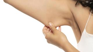 Imagen ilustrativa de unos brazos.