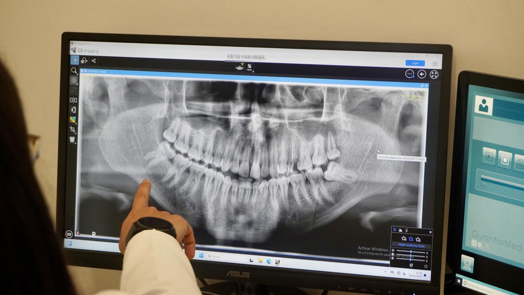 La Dra. Domínguez visualiza una ortopantomografía recién realizada de uno de los migrantes.