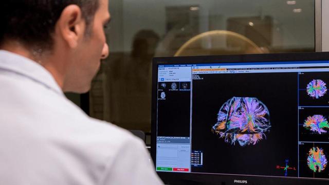 La genética juega un importante papel en el desarrollo de las demencias y el alzhéimer.