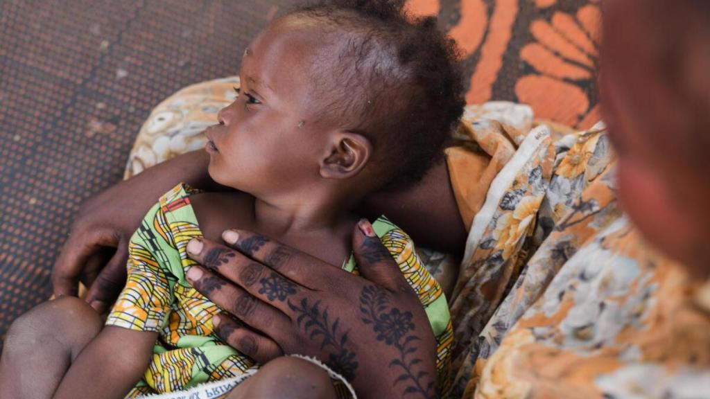 La crisis alimentaria afecta a los niños y niñas de Chad.