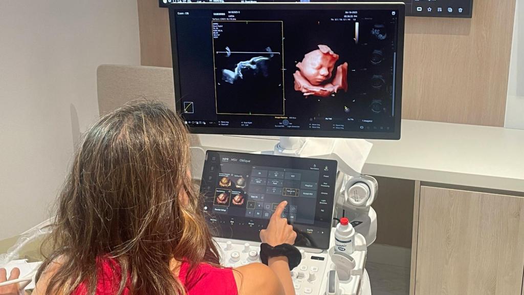 La doctora María del Mar Gil realizando una ecografía con el equipo Z20 de Samsung.