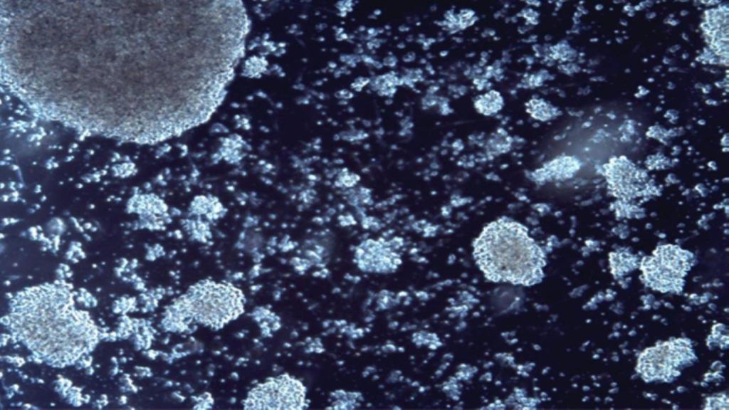 Imagen de células CAR-T.