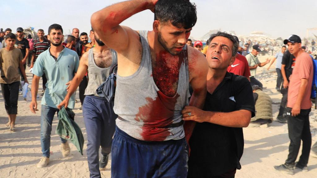 Un gazatí herido durante el ataque de Israel a las 'colas del hambre' este lunes.