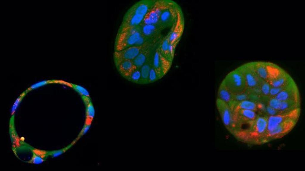Organoides hepáticos derivados del paciente y sus mitocondrias (rojo).