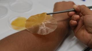 El apósito que se aplica sobre las heridas para reducir el crecimiento bacteriano.