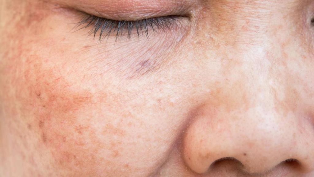 Imagen del rostro de una mujer.