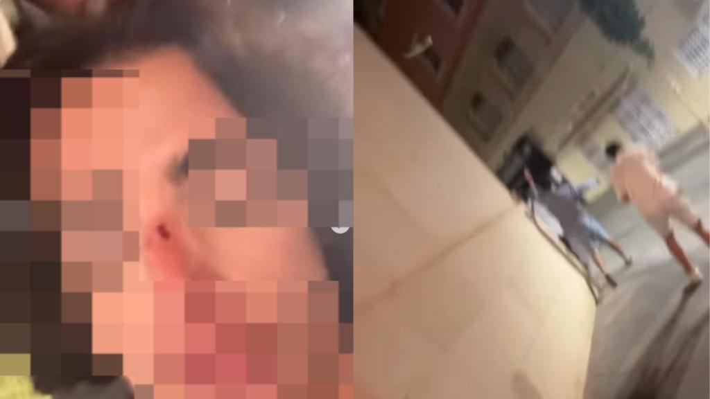 Las lesiones en el rostro y el instante en que lanzan la botella.