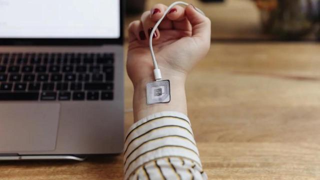 Imagen de un chip implantado en un brazo.