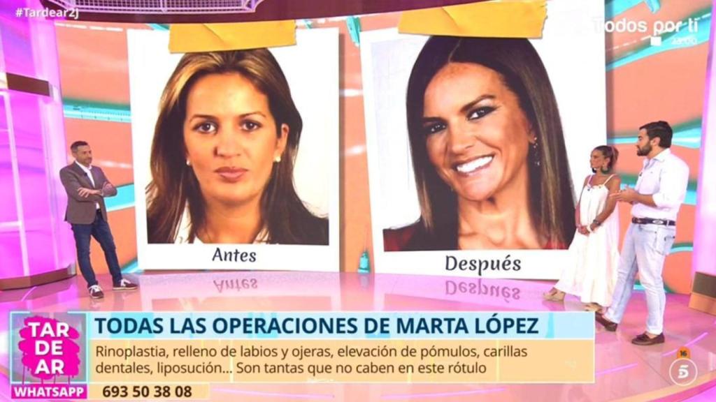 Cambio físico de Marta López.