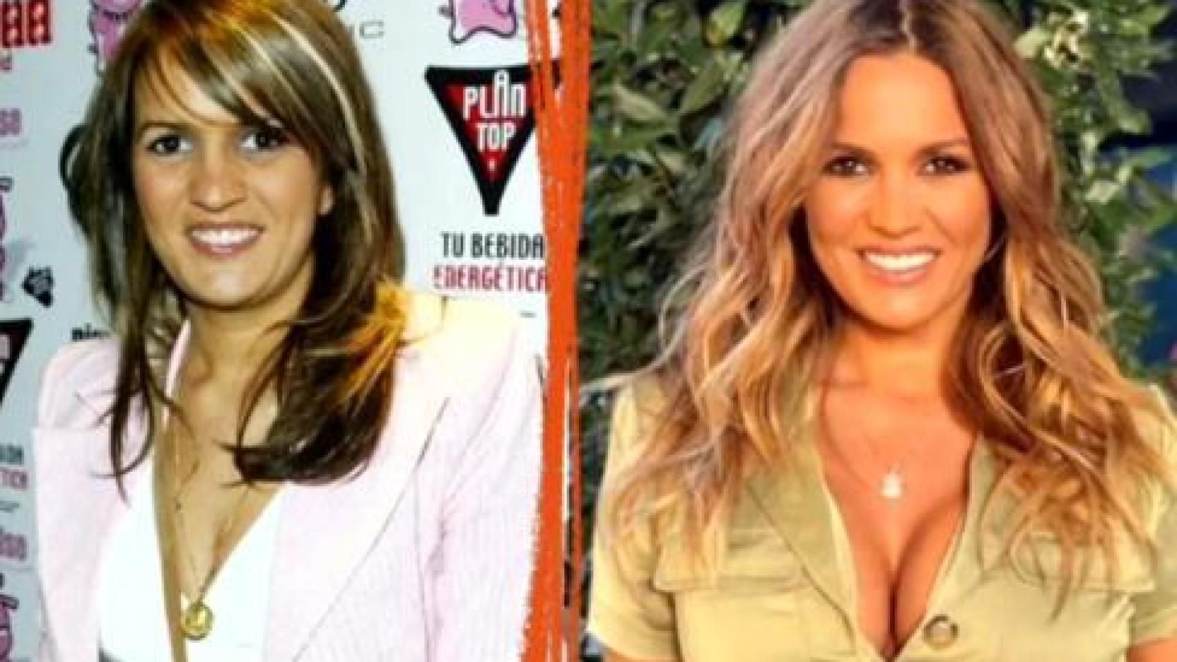 Los retoques estéticos de Marta López.