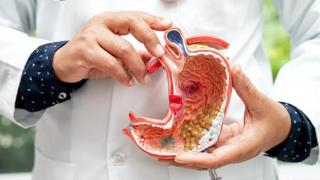 Cáncer de estómago. The Cancer Center.