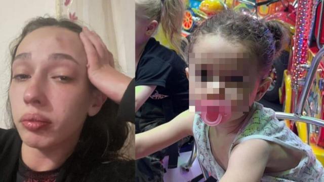 A la izquierda, una imagen de Alba tras ser presuntamente golpeada por su expareja; y a la derecha una foto de su hija, Khaley.